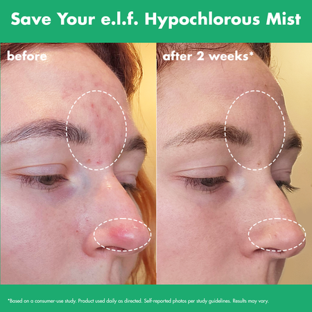 e.l.f. Save Your e.l.f. brume visage acide hypochloreux apaisante