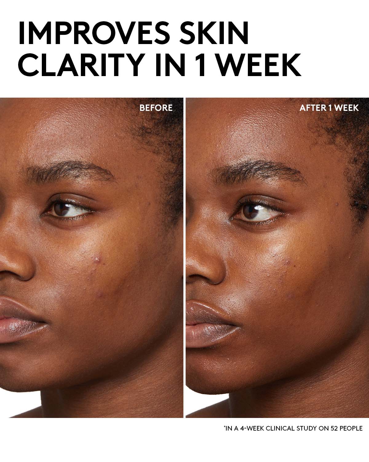 Fenty Beauty Cherry Dub Lotion BHA Acide Salicylique 150 ml