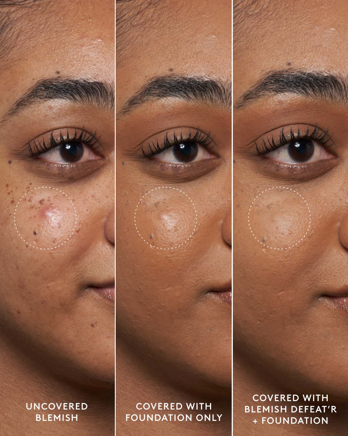 Fenty Beauty Blemish Defeat'r gel anti-imperfections 15 ml