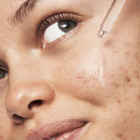 e.l.f. Blemish Breakthrough Sérum Triple Acide Nuit Niacinamide