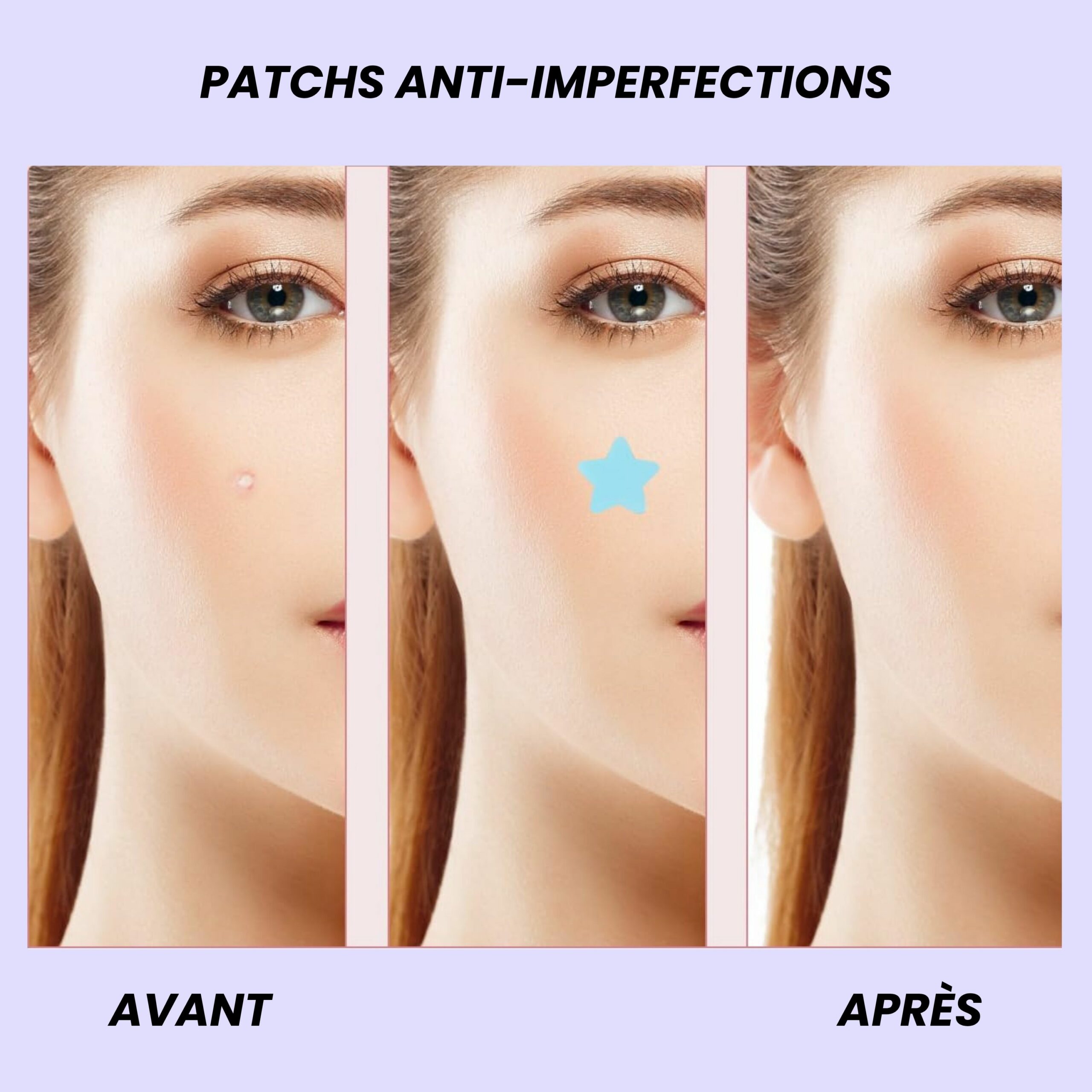 GLAM'UP Perfect Skin patch anti-imperfections boutons