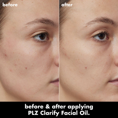 E.L.F. PLZ Clarify Huile Visage Acide Salicylique 2% Points Noirs