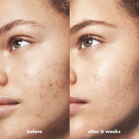 e.l.f. Blemish Breakthrough Crème Hydratante Anti-Imperfections