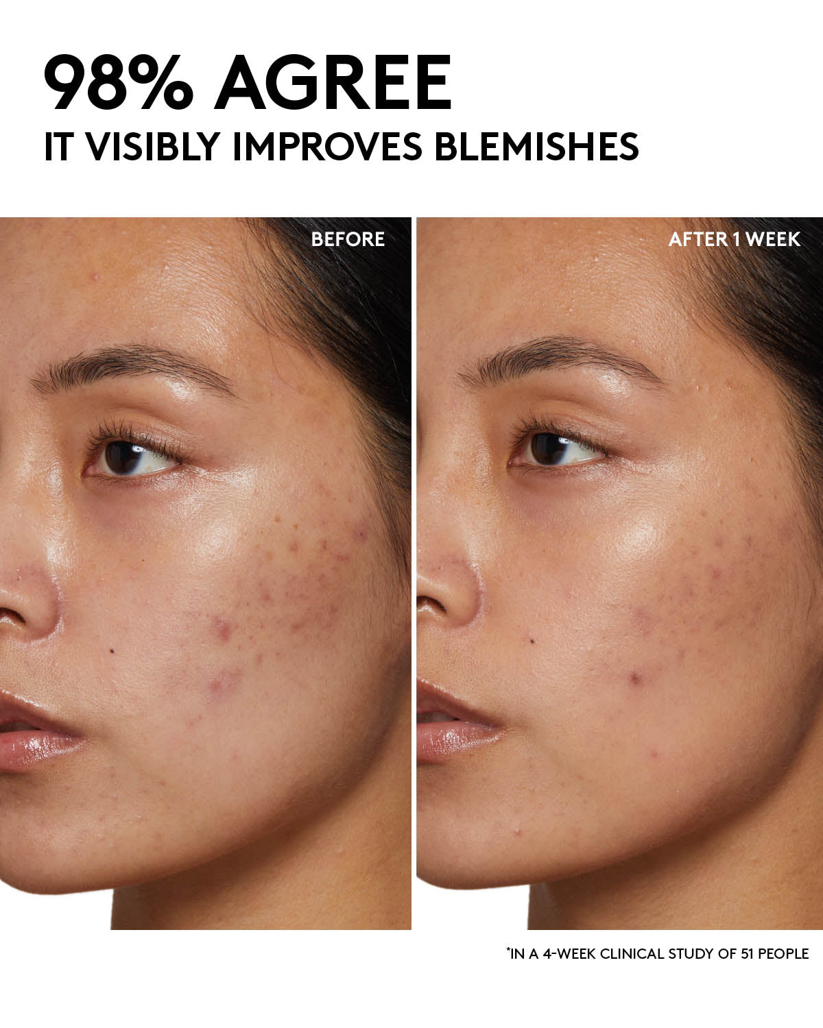 Fenty Beauty Cleanser Cherry Dub Gel Nettoyant 185 ml Éclat