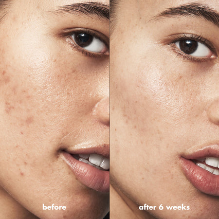 E.L.F. Blemish Breakthrough nettoyant visage anti-acné