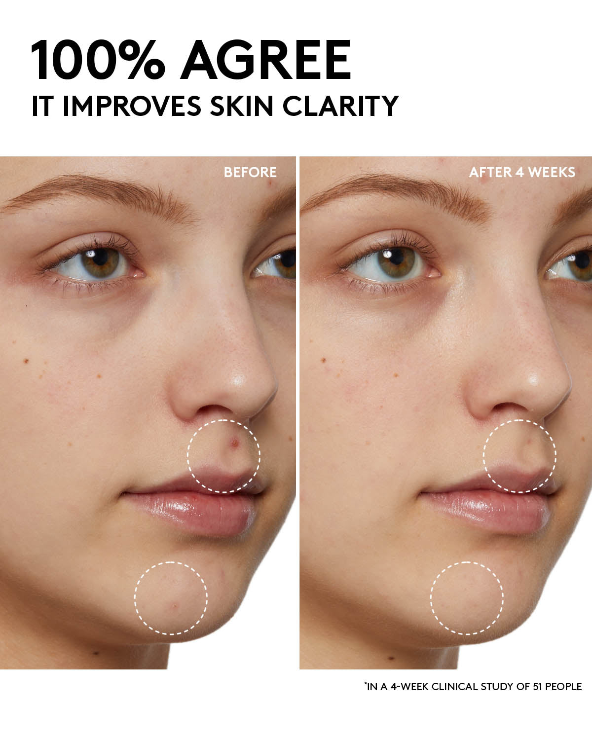 Fenty Beauty Cleanser Cherry Dub Gel Nettoyant 185 ml Éclat