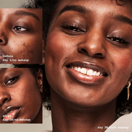 E.L.F Face Acne Fighting Putty Primer base anti-acné